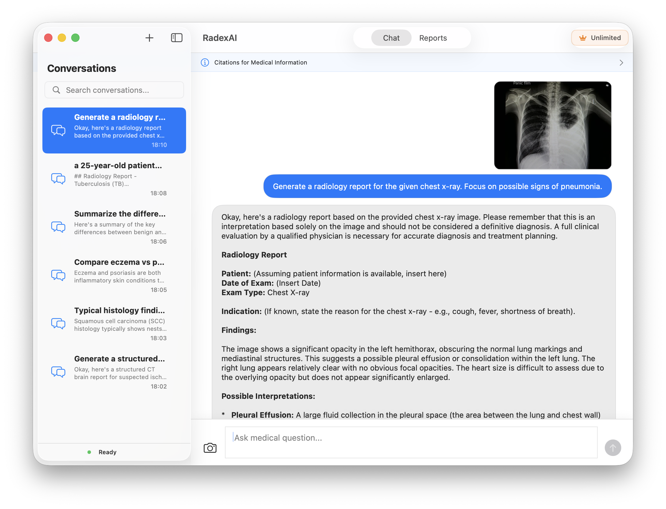 Radex AI app screenshot